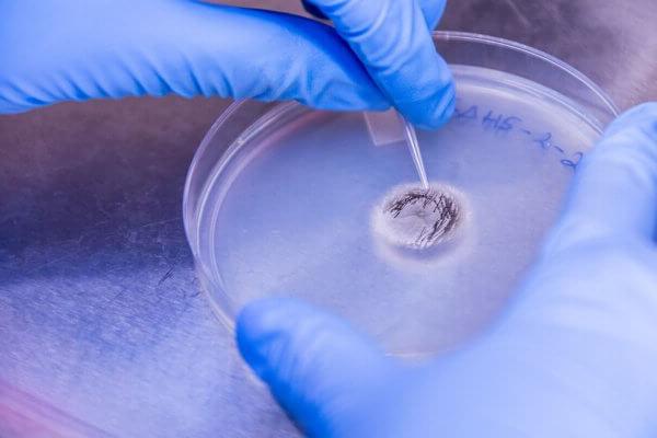 Photo of petri dish used in Teresa Zielinski's research at Shenandoah University.